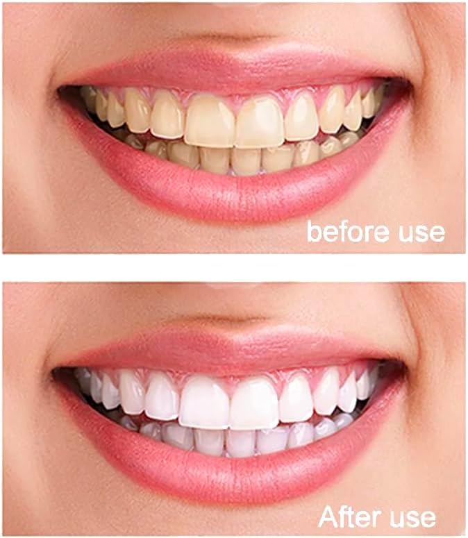 99.5% Pure Nano Hydroxyapatite Powder for DIY Toothpaste, Teeth Whitening & Soap Making 120 Grams