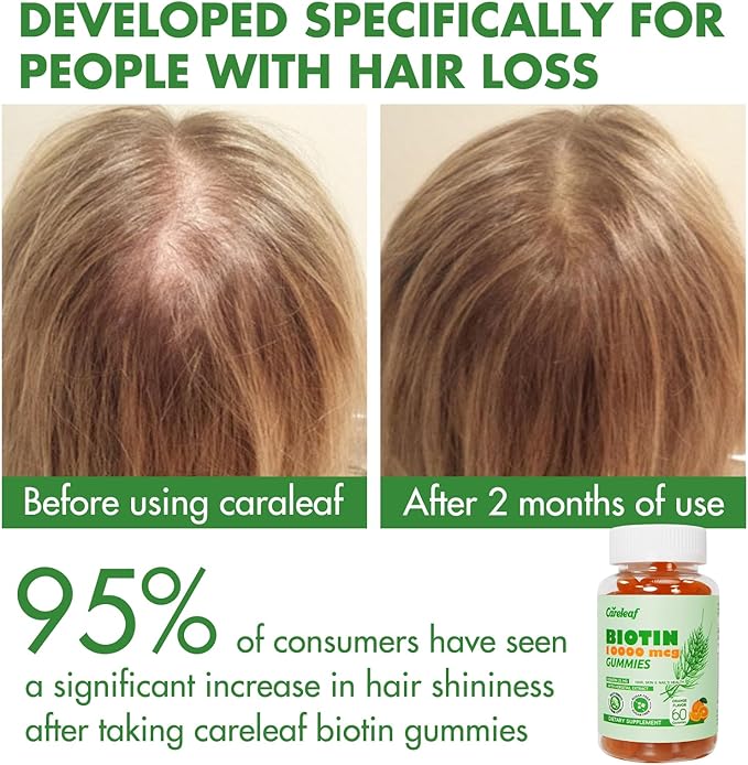 Sugar Free Biotin Gummy Hair, Nails & Skins Gummies-2500mcg Enhanced Hair, Skin & Nails Supplement Orange Flavor 60 Cts/Bottle