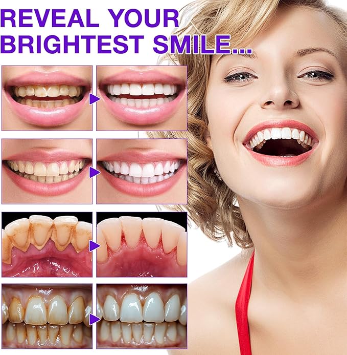 Toothpaste Tablets, Chewable Toothpaste Tablets for Fresh Breath, Natural Whitening Floride-Free and Remineralizing Tablets Tabs, Nano Hydroxyapatite Toothpaste, 150 Tablets