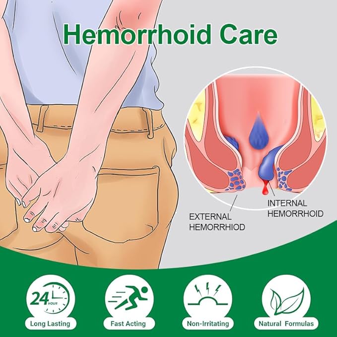 vamy Herbal Hemorrhoid Cream, Hemorrhoid Treatment and Hemorrhoids Cream with Lidocaine 4% and Phenylephrine HCI for Fast Relief of Pain, Swelling, Itching, Burning, Hemorrhoidal Treatment. 2 pc