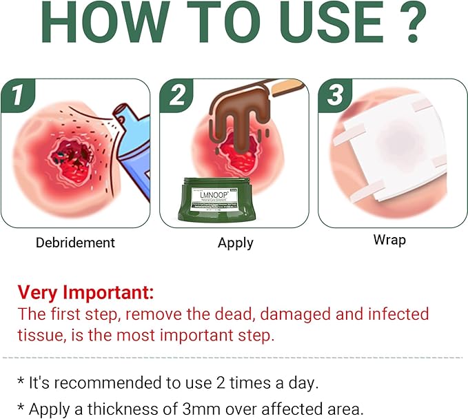 Perianal Repair Ointment: Treatments for Anal Fistula, Anal Fissure, Perianal Abscess, Rapid Relief from Pain, Burning, Itching, Swelling, Bleeding, and Discomfort by Jock Itch or Hemorrhoids